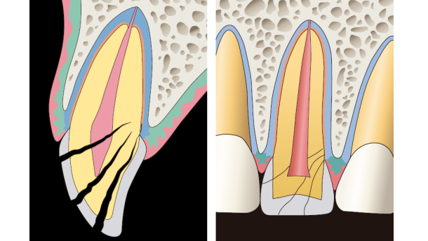 ‘Tandletsel hoort thuis bij de algemeen practicus’