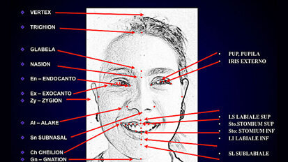 Asertividad en estética dental