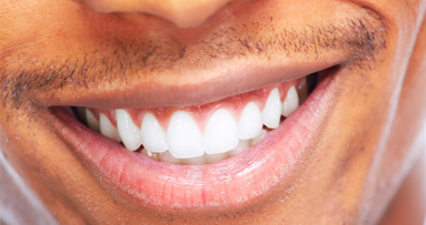 Auch hinter Gittern weiße Zähne