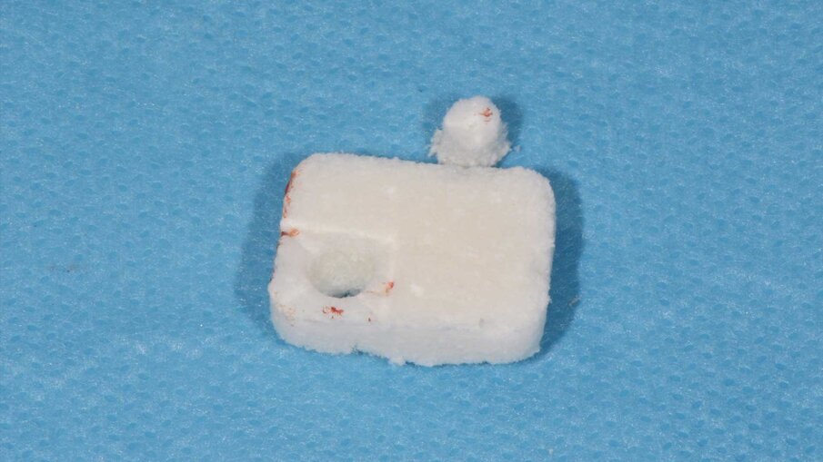 Fig. 5 - La matrice Geistlich Fibro-Gide è sagomata secondo la “Collagen-Ring Technique”.