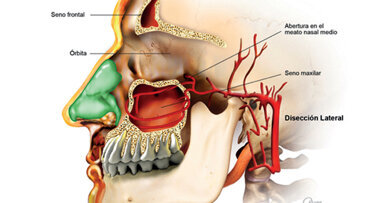 La importancia de la anatomía sinusal