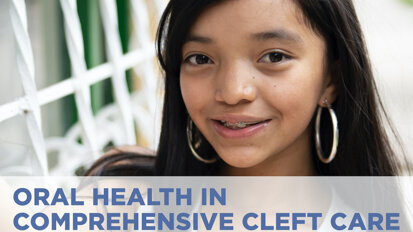 FDI webinar to discuss oral health in comprehensive cleft care FDI webinar to discuss oral health in comprehensive cleft care