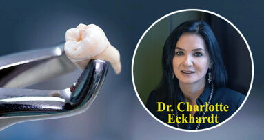 Dental surgeon alarmed by spike in decay-related tooth extractions