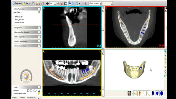 Materialise Dental and Zimmer Dental establish partnership