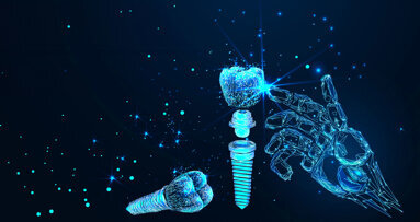 Post-COVID recovery fuels success of cost-conscious dental implant solutions and digital dentistry