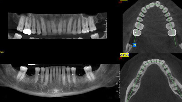 Mobile CBVI vans give dentists benefits of the technology without the cost