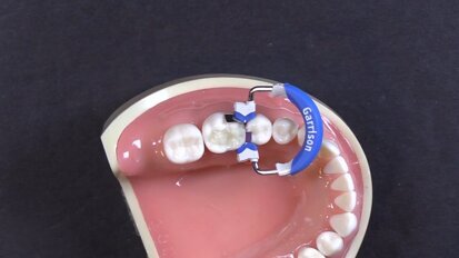 Quick Tip #3 Rolling the Marginal Ridge