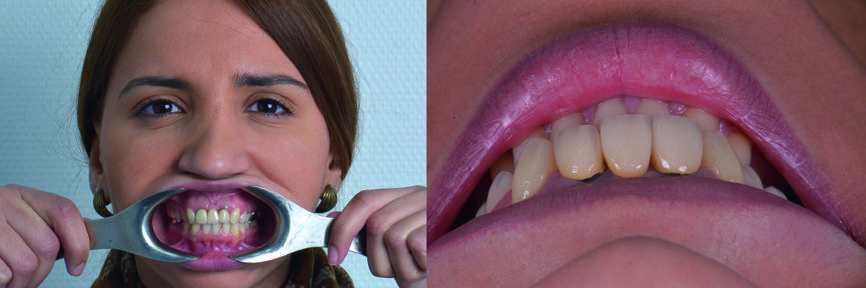 Fig. 3 : Vue préopératoire (prise du dessus). 