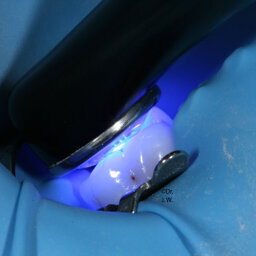 VALO Polymerisationsleuchten von Ultradent Products