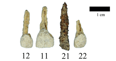 Ältestes Implantat Westeuropas entdeckt