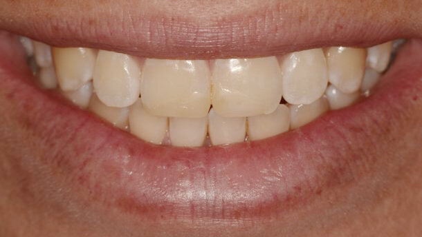 Color y forma: los objetivos de estética