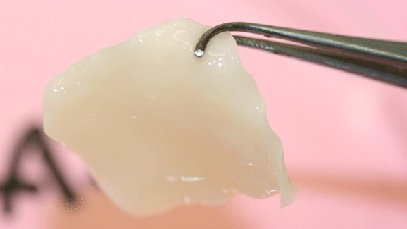 Neue Möglichkeiten für die Gesichtschirurgie