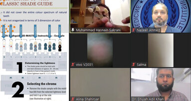 AIDM webinar on 3D shade guide, teeth selection