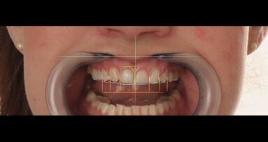 Digital Smile Design: “meer communicatievorm dan techniek”