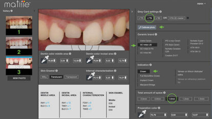 Intégrer la teinte d’une incisive centrale unitaire du premier coup