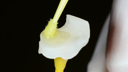 Easy and efficient: Composite resin blocks for the CAD/CAM technique