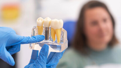 New implant prognosis model shows strong five-year predictive value