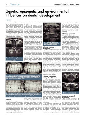Ortho Tribune U.S.