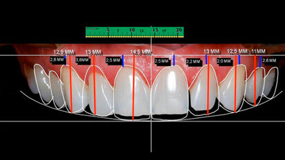 “La componente estetica” di Gürel e Coachman: splendida relazione ad AdB 2013