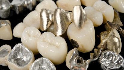 ADA offers advice on how to handle dental scrap ADA offers advice on how to handle dental scrap