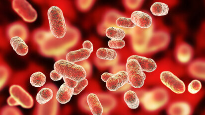 Doença periodontal e doença arterial coronariana compartilham base genética