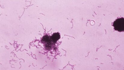 Científicos chilenos afirman haber descubierto una molécula anticaries