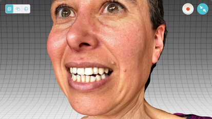 3D face scanning: Affordable and user-friendly