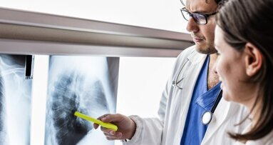 Dentisti sviluppano un test della saliva per la diagnosi precoce del cancro al polmone