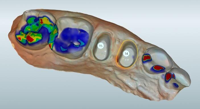 Fig. 5: Margin tracking
