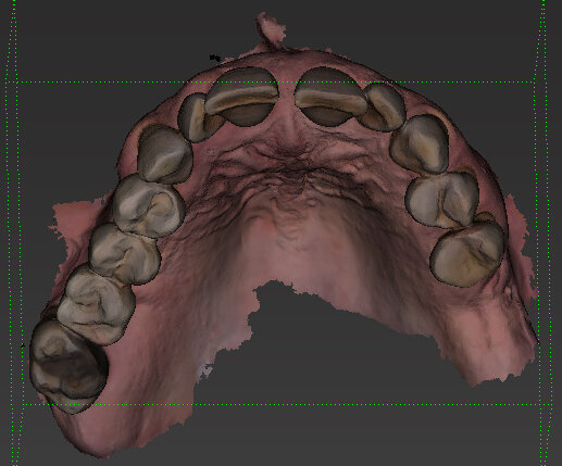 Fig. 6 - Visione occlusale.