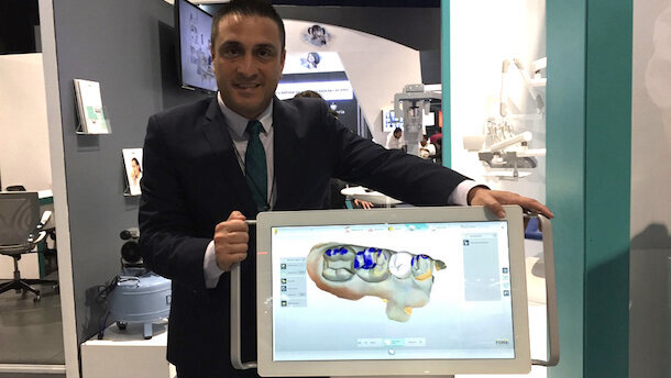 MyCrown, restauraciones en dos horas desde el sillón