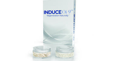 Bioavailable growth factors for bone regeneration