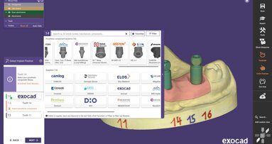 Exocad DentalCAD 3.3 Chemnitz release: Implant Module—enhanced workflow for individual abutments