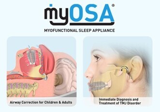 myOSA® - Myofunctional Sleep Appliance