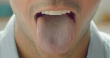 Causes et traitement de l’halitose