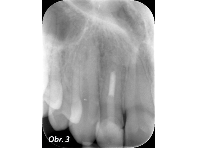 Obr. 3: Stav při poslední kontrole (2017)