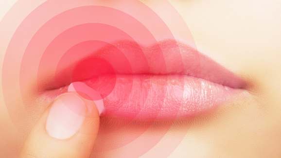 Jeder zweite Österreicher hatte schon mal Fieberbläschen