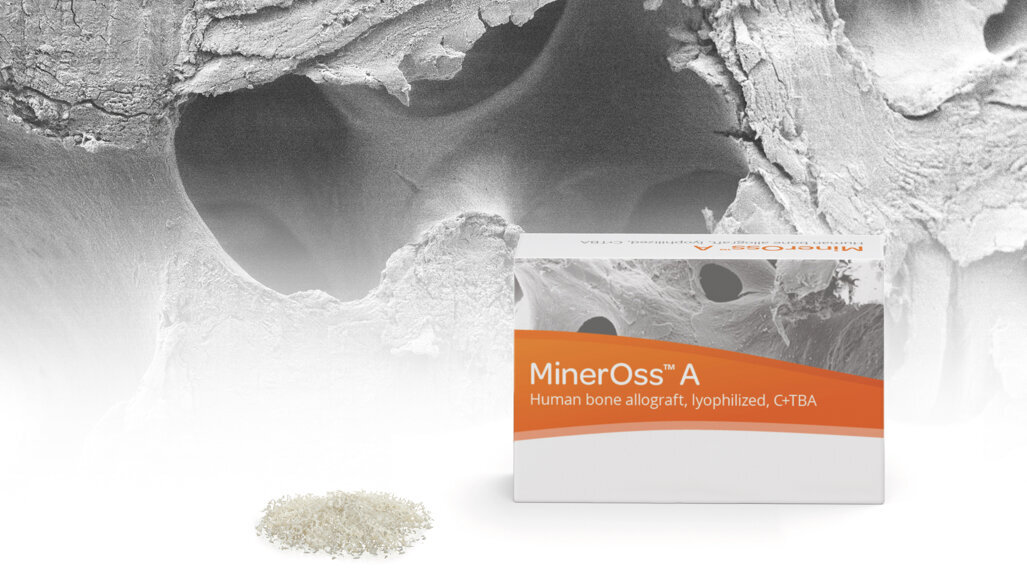 Camlog adds allogeneic products to its biomaterials portfolio