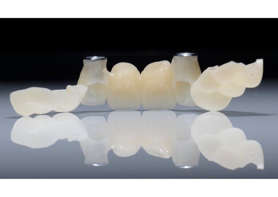 Fig. 54 - Provvisorio finalizzato. 