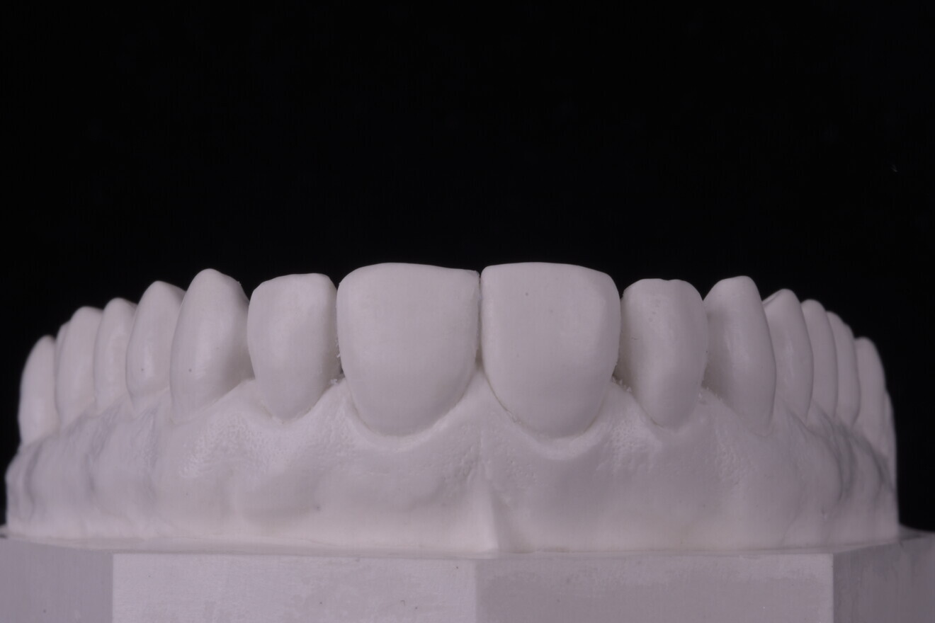 Fig. 2: Pre-op diagnostic model.