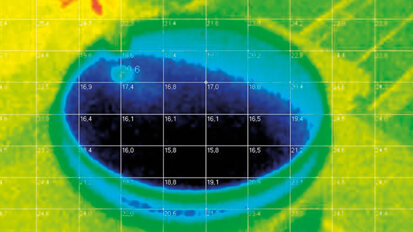 Aspetti biochimici, fisici e clinici del laser nella gestione delle mucositi