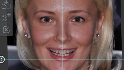 Technologia z Brazylii stworzy symetryczne uśmiechy