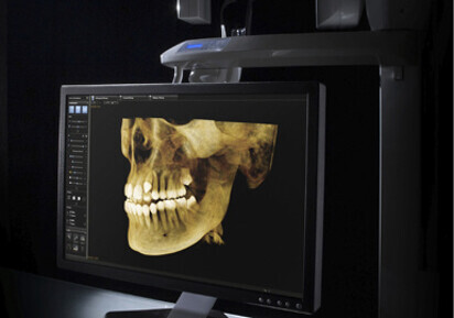 Carestream Dental introduces CS 9300-1