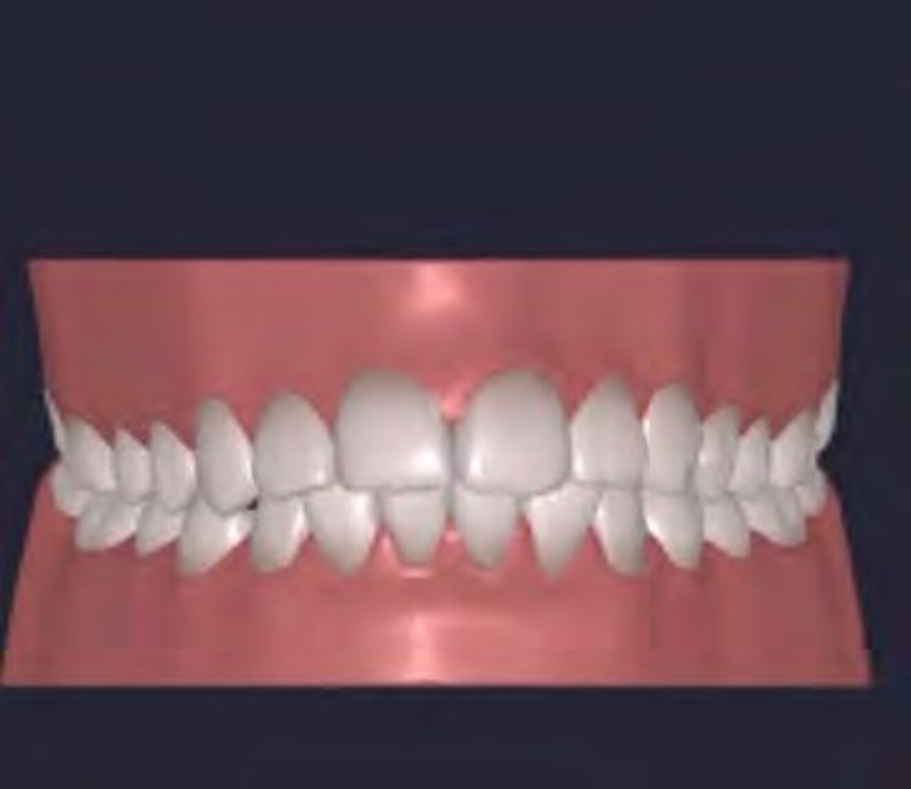 2e