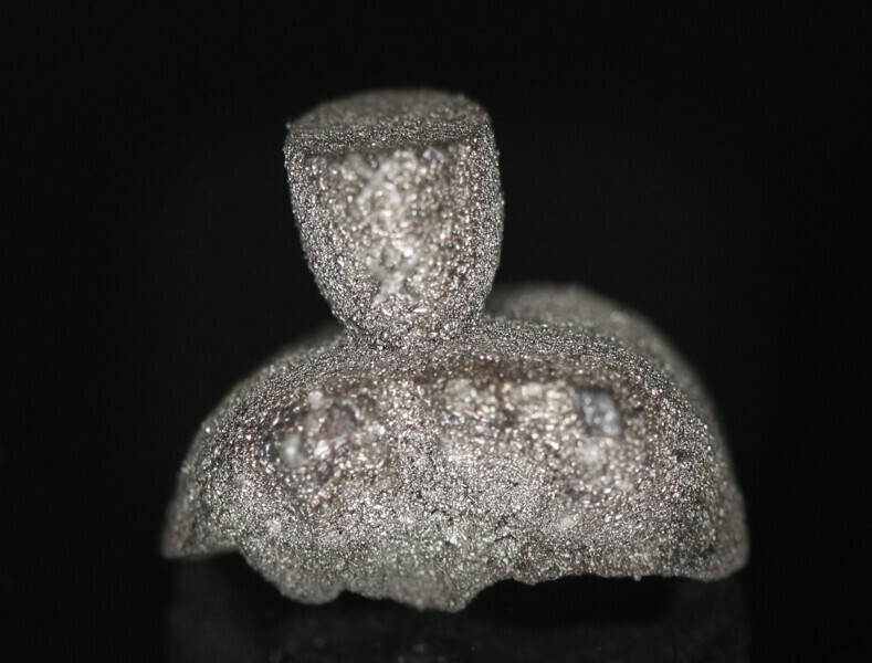 Fig. 5: Additive manufactured onlay.