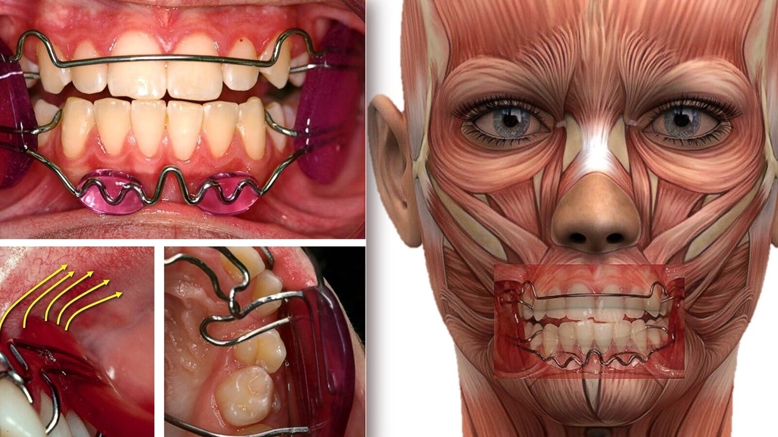 Los beneficios en la salud general de la Ortodoncia Médica