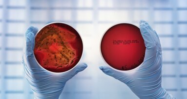 Une thérapie antibactérienne à domicile améliore les résultats parodontaux dans un essai randomisé