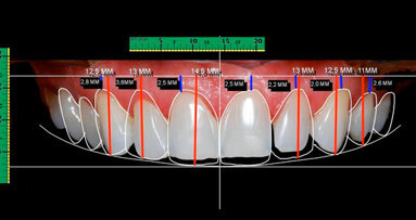 “La componente estetica” di Gürel e Coachman: splendida relazione ad AdB 2013