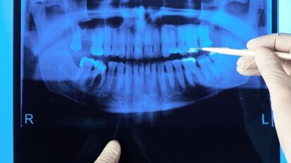 ANVS inspecteert tandartspraktijken