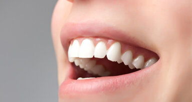 Rheinland-Pfälzer haben gesunde Zähne